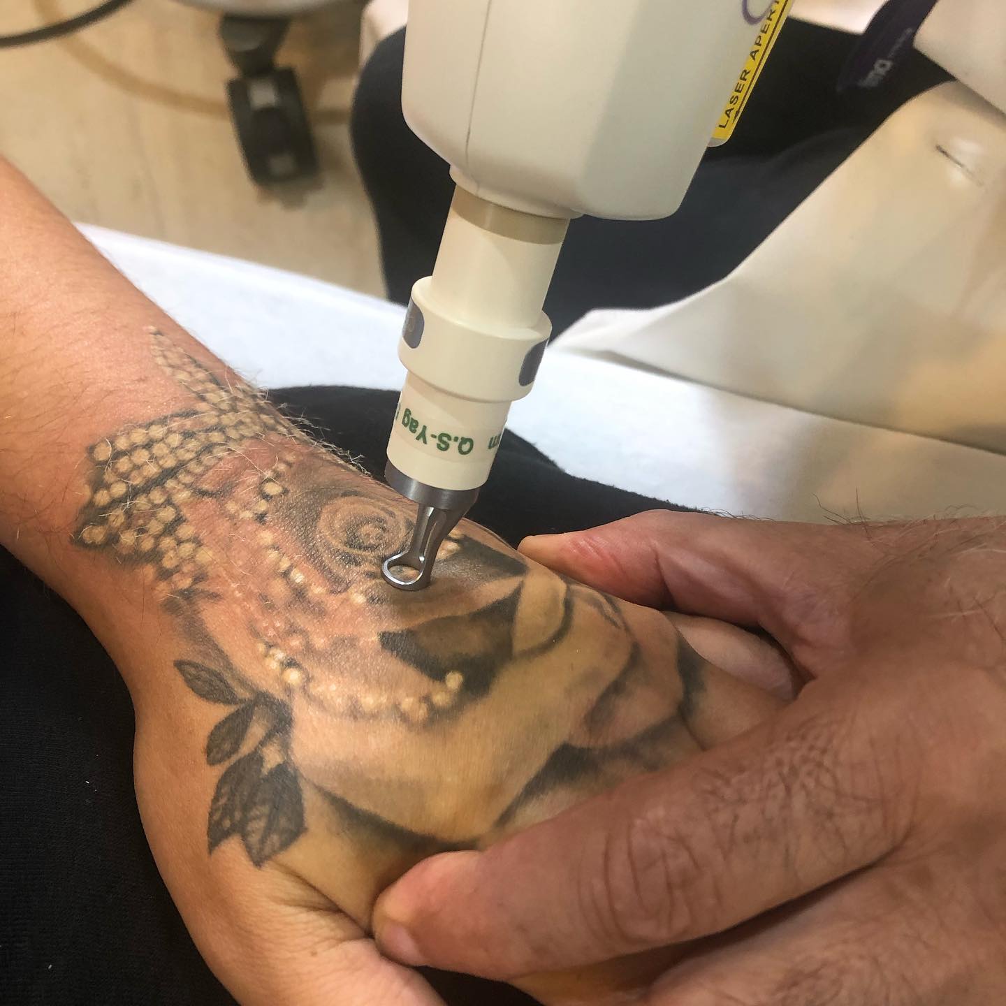 Motor City Tattoo Studiooshawaon  Check out this laser tattoo removal  success story A client had a large piece removedfaded with us here at MCT  then covered up the new empty space