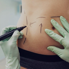 Surgical