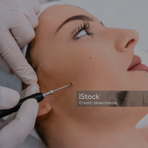 vascular pigmented
