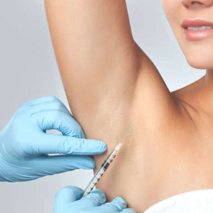 Hyperhidrosis