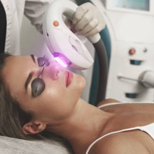 IPL skin rejuvenation IPL skin rejuvenation