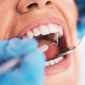 dental check ups