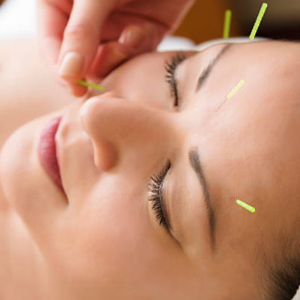 facial acupuncture