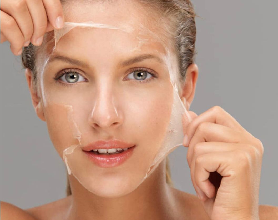 chemical peel