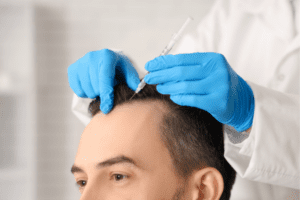 What happens during a hair transplant