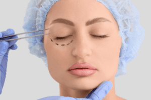 lower blepharoplasty UK 